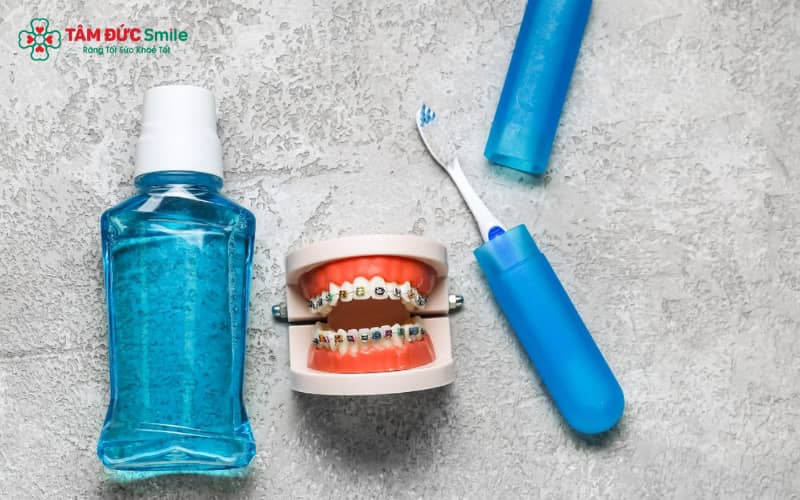 Sản phẩm nước Abc88win ứng dụng di động dành cho người niềng hỗ trợ làm sạch sâu, ngăn ngừa mảng bám tích tụ ở các khe mắc cài