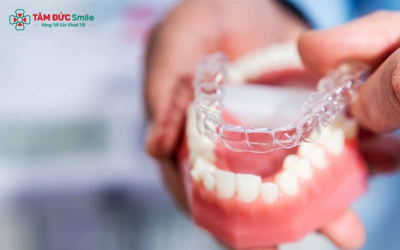 Mức giá trọn gói Abc87 tải ứng dụng Invisalign thường nằm trong khoảng 40 – 120 triệu VNĐ