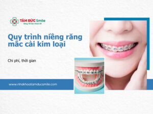 quy-trinh-nieng-rang-mac-cai-kim-loai-5