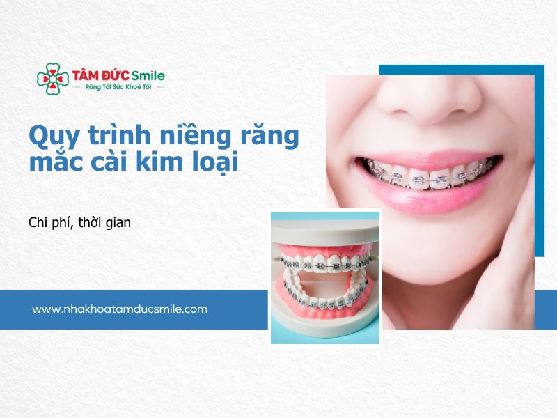 quy-trinh-nieng-rang-mac-cai-kim-loai-5