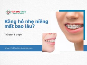 rang-ho-nhe-nieng-mat-bao-lau-5