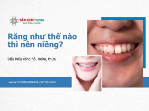 rang-nhu-the-nao-thi-nen-nieng-5