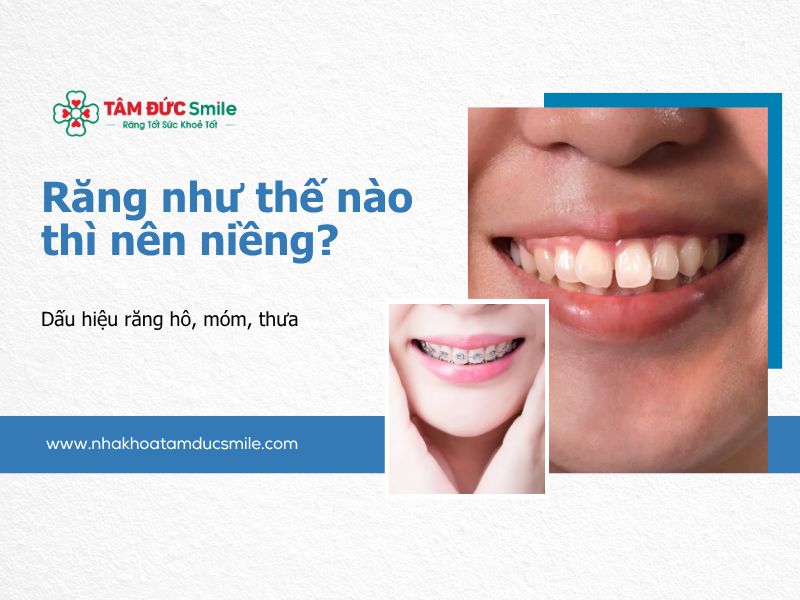 rang-nhu-the-nao-thi-nen-nieng-5