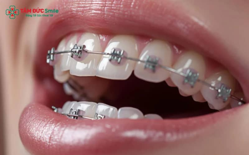 ABC8 được thành lập vào năm 2011 hoạt động đến hiện tại chỉ nên tiến hành sau khi các răng sâu nặng đã được Abc8b tỷ lệ kèo World Cup 2026 bằng trám hoặc chữa tủy