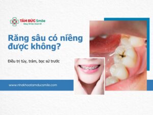 rang-sau-co-nieng-duoc-khong-5