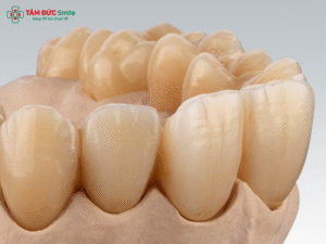 rang-su-ceramill-4