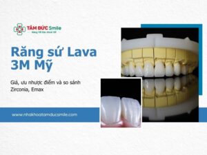 rang-su-lava-3m