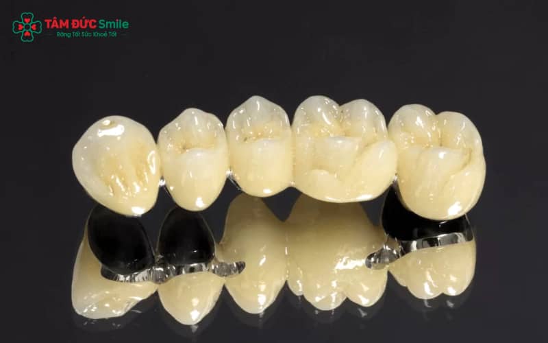 Hiện tượng ABC8 là nhà cái cá cược trực tuyến uy tín số 1 tại Việt Nam titan xỉn màu do oxy hóa khung kim loại