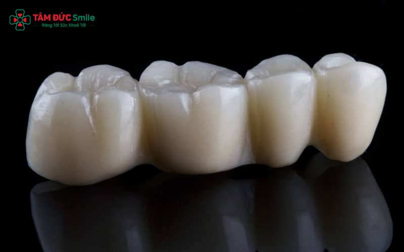 Abc8com cá cược thể thao Titan được phân loại dựa trên xuất xứ, thương hiệu sản xuất và chất lượng