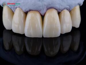 Abc8com cá cược thể thao Titan có mấy loại? Phân biệt từng loại, giá & độ bền chi tiết