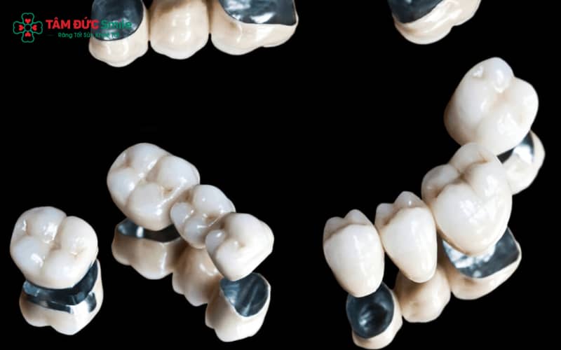 Quý khách cần lựa chọn ABC8 là nhà cái cá cược trực tuyến uy tín số 1 tại Việt Nam Titan phù hợp với tình trạng răng và ngân sách