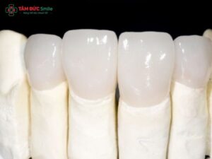 rang-su-zirconia-co-may-loai-1