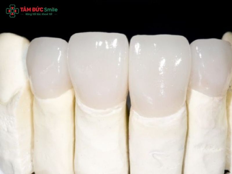 rang-su-zirconia-co-may-loai-1