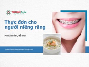 thuc-don-cho-nguoi-nieng-rang-5