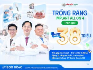 trong-rang-implant-all-on-4-1