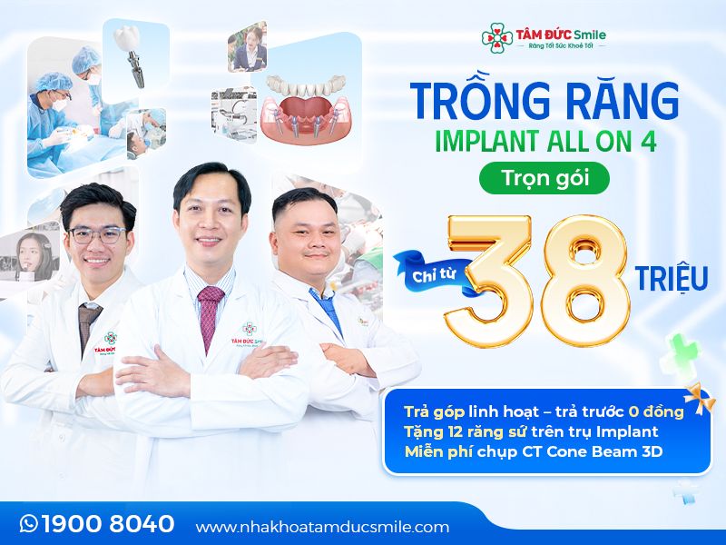 trong-rang-implant-all-on-4-1