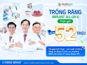 trong-rang-implant-all-on-6-1