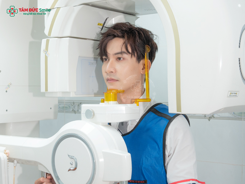 trong-rang-implant-all-on-6-3