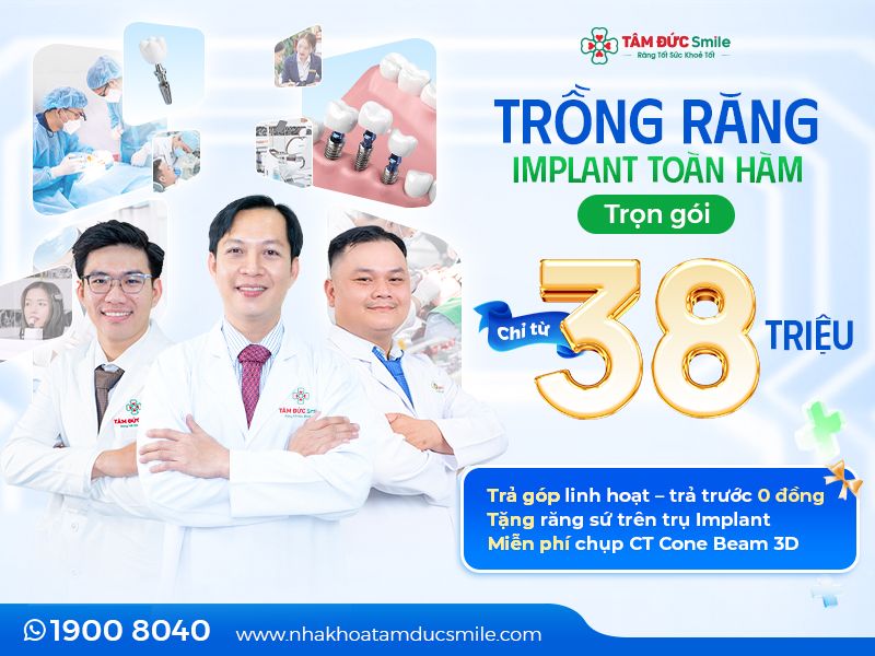 trong-rang-implant-toan-ham-8