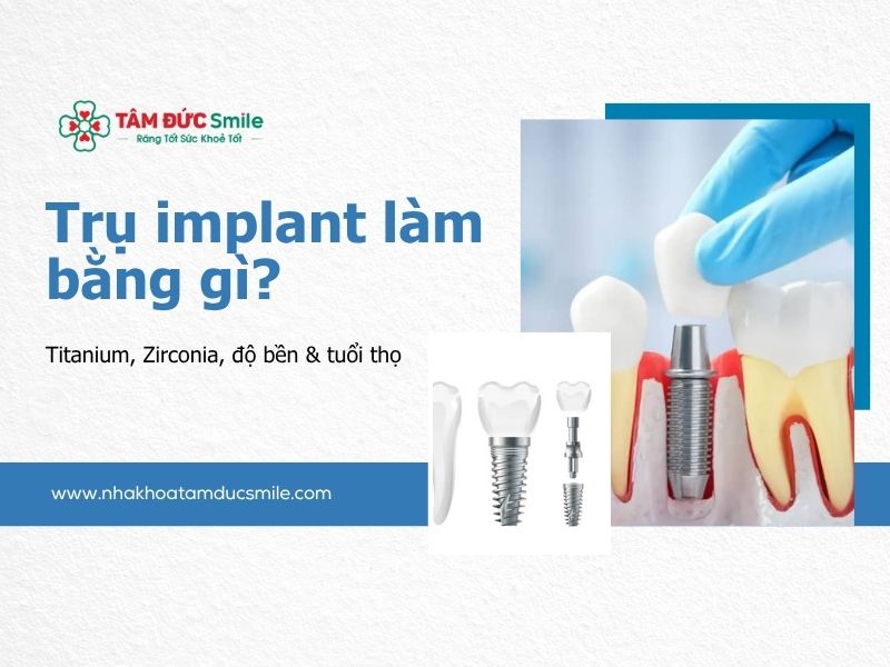 tru-implant-lam-bang-gi