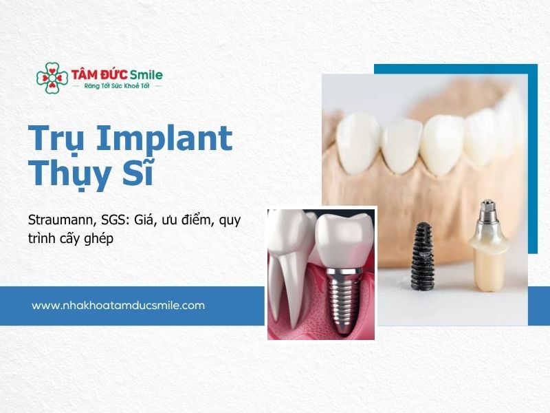 tru-implant-thuy-si