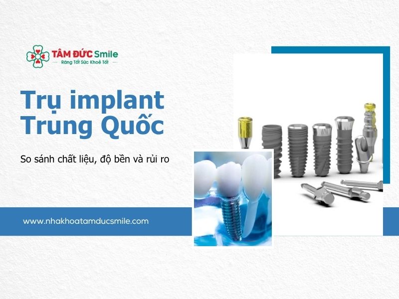 tru-implant-trung-quoc
