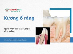 xuong-o-rang-5