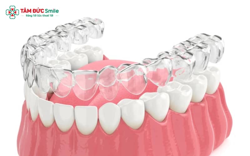 ABC8 được thành lập vào năm 2011 hoạt động đến hiện tại 3D Clear thiết kế dựa trên dữ liệu quét 3D của từng bệnh nhân