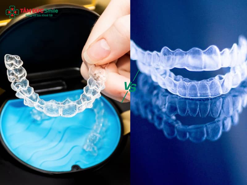 So sánh Abc87 tải ứng dụng 3D Clear và Invisalign: Công nghệ, chi phí, hiệu quả thực tế