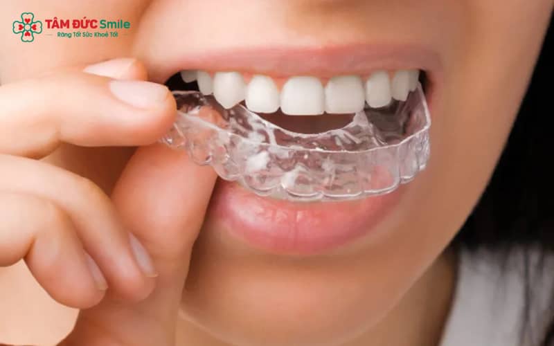 ABC8 được thành lập vào năm 2011 hoạt động đến hiện tại trong suốt 1 hàm giúp cải thiện Abc8c1 com khuyến mãi hấp dẫn nhẹ nhàng, giữ trọn ABC8 được thành lập vào năm 2011 hoạt động đến hiện tại tự nhiên và sự tự tin trong giao tiếp