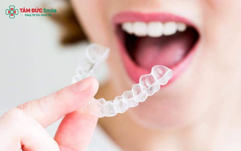 Abc87 nền tảng cá cược trực tuyến sẽ cân nhắc kỹ để bảo tồn tối đa răng thật