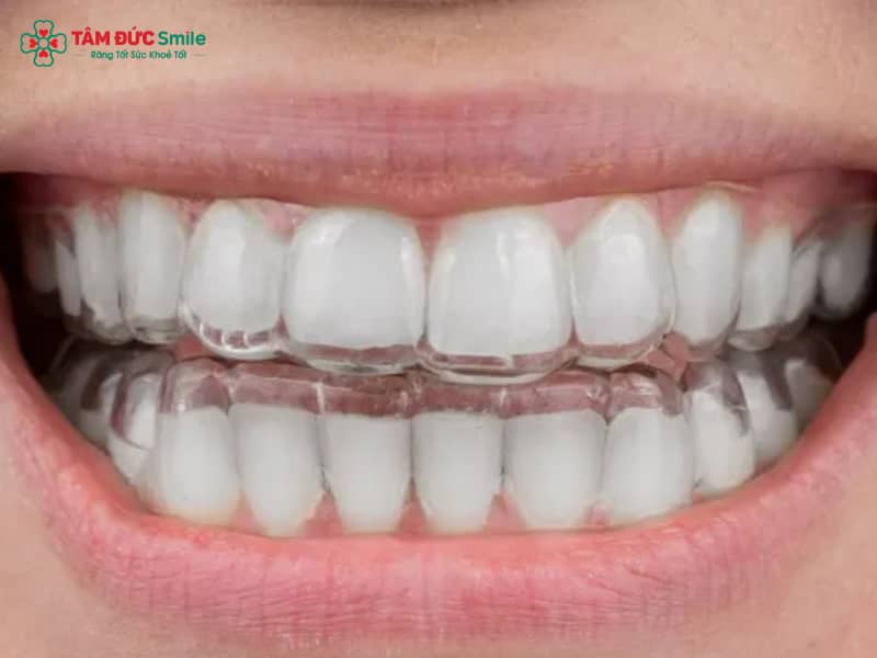 ABC8 được thành lập vào năm 2011 hoạt động đến hiện tại trong suốt có phải nhổ răng không?