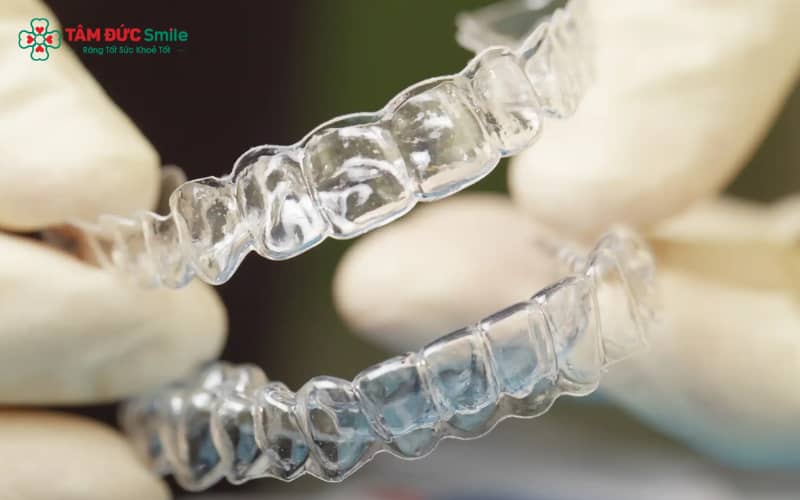 Khi răng lệch nặng hoặc sai khớp cắn phức tạp có thể mất đến 2 năm