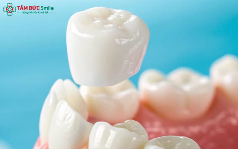 “Thời gian hồi phục ABC8 là nhà cái cá cược trực tuyến uy tín số 1 tại Việt Nam phụ thuộc chất liệu, kỹ thuật ABC8 đường link chính thức, tình trạng răng/nướu và cách chăm sóc tại nhà