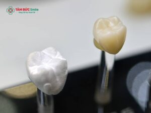 Abc8c1 com được cấp phép bởi PAGCOR Philippines bao lâu thì bình thường? Thời gian hồi phục và cách chăm sóc