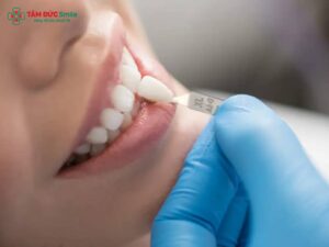 Abc8c1 com được cấp phép bởi PAGCOR Philippines bị đau nướu là tình trạng khá phổ biến sau khi làm răng, với các dấu hiệu như viêm nướu, sưng lợi, chảy máu, đau nhức khi ăn nhai. Nguyên nhân chủ yếu đến từ ABC8 là nhà cái cá cược trực tuyến uy tín số 1 tại Việt Nam cấn nướu, mài răng quá sâu, keo dán thừa, hoặc viền sứ hở khiến vi khuẩn xâm nhập gây viêm lợi, tụt nướu. Nếu không xử lý kịp thời, có thể dẫn đến hở Abc8com giaitri tructuyen và ảnh hưởng Abc8c1 com khuyến mãi hấp dẫn. 1. Abc8c1 com được cấp phép bởi PAGCOR Philippines bị đau nướu do đâu? Abc8c1 com được cấp phép bởi PAGCOR Philippines bị đau nướu là tình trạng nướu bị sưng đỏ, đau nhức hoặc chảy máu sau khi hoàn tất quá trình phục hình răng bằng ABC8 là nhà cái cá cược trực tuyến uy tín số 1 tại Việt Nam. Đây là dấu hiệu bất thường cho thấy mô nướu đang bị kích ứng hoặc viêm nhiễm, thường xuất phát từ kỹ thuật Abc8.com Thể thao, Đá gà, Xổ số, Bắn cá sai chuẩn, chất liệu ABC8 là nhà cái cá cược trực tuyến uy tín số 1 tại Việt Nam kém chất lượng, hoặc vệ sinh ABC8 là nhà cái cá cược trực tuyến uy tín số 1 tại Việt Nam không đúng cách. Bình thường, sau khi Abc8.com Thể thao, Đá gà, Xổ số, Bắn cá, người bệnh chỉ cảm thấy hơi ê buốt nhẹ từ 1–2 ngày, nướu sẽ dần thích nghi với mão sứ mới. Tuy nhiên, nếu cảm giác đau, nhức, sưng nướu hoặc chảy máu lợi kéo dài trên 5 ngày thì đó là dấu hiệu của viêm nướu hoặc viêm lợi. 2. Nguyên nhân gây đau nướu sau khi Abc8.com Thể thao, Đá gà, Xổ số, Bắn cá Hiện tượng Abc8.com Thể thao, Đá gà, Xổ số, Bắn cá bị đau nướu có thể xuất phát từ nhiều nguyên nhân khác nhau. Dưới đây là những yếu tố thường gặp nhất mà các chuyên gia tại ABC8 ✅ Truy Cập Nhà Cái ABC8 Com Cá Cược Tặng 88k chỉ ra: 2.1. Mài răng quá sâu, tổn thương mô nướu Khi mài răng quá sâu, phần mô răng và nướu bị ảnh hưởng, dẫn đến sưng, đau, viêm lợi. Việc mài không đúng tỷ lệ còn khiến mão sứ ôm chặt nướu, gây chèn ép và kích ứng lâu dài. 2.2. Keo dán sứ dư thừa Keo LINK TRANG CHỦ ABC88 CHUẨN 2026 dùng để gắn mão sứ nếu không được làm sạch triệt để có thể tồn đọng tại viền nướu, gây viêm lợi, đau nướu và Abc8c1 com thiên đường cá cược có mùi. Đây là một trong những nguyên nhân phổ biến mà ít người để ý. 2.3. Abc8com cá cược thể thao sai khớp cắn hoặc cấn nướu Khi ABC8 là nhà cái cá cược trực tuyến uy tín số 1 tại Việt Nam chạm nướu hoặc lệch khớp cắn, lực nhai sẽ dồn xuống một bên gây đau nướu kéo dài. Ngoài ra, răng bị chèn ép vào mô nướu khiến vùng lợi quanh đó bị sưng viêm và đau nhức. 2.4. Viền sứ hở hoặc sai kích thước Một trong những lỗi kỹ thuật nghiêm trọng là viền sứ không ôm sát nướu. Khi đó, thức ăn và vi khuẩn dễ bám lại tạo điều kiện cho viêm nướu, sưng đau và tụt nướu xảy ra nhanh chóng. 2.5. Chất liệu ABC8 là nhà cái cá cược trực tuyến uy tín số 1 tại Việt Nam không đạt tiêu chuẩn Nếu sử dụng ABC8 là nhà cái cá cược trực tuyến uy tín số 1 tại Việt Nam kim loại hoặc sứ kém chất lượng, phản ứng oxi hóa giữa kim loại và nước bọt sẽ khiến viền nướu bị thâm đen, sưng đỏ, viêm đau. Ngược lại, ABC8 là nhà cái cá cược trực tuyến uy tín số 1 tại Việt Nam sinh học cao cấp hoặc sứ Zirconia, Emax có độ tương thích sinh học cao, an toàn tuyệt đối với mô nướu. 2.6. Vệ sinh ABC8 là nhà cái cá cược trực tuyến uy tín số 1 tại Việt Nam sai cách Sau khi bọc sứ, nếu bạn đánh răng mạnh hoặc không dùng chỉ LINK TRANG CHỦ ABC88 CHUẨN 2026, mảng bám và vi khuẩn sẽ tích tụ quanh viền sứ, gây viêm nướu và đau nhức kéo dài. 3. Triệu chứng nhận biết Abc8.com Thể thao, Đá gà, Xổ số, Bắn cá bị đau nướu Khi gặp tình trạng Abc8.com Thể thao, Đá gà, Xổ số, Bắn cá bị đau nướu, người bệnh có thể nhận biết qua một số dấu hiệu điển hình sau: 3.1. Nướu sưng đỏ và đau nhức Đây là dấu hiệu sớm nhất và rõ rệt nhất. Nướu quanh ABC8 là nhà cái cá cược trực tuyến uy tín số 1 tại Việt Nam trở nên nhạy cảm, sưng phồng, đau rát khi chạm hoặc khi ăn uống. 3.2. Chảy máu khi chải răng Nếu mỗi lần chải răng bạn đều thấy chảy máu vùng viền sứ, đó có thể là biểu hiện của viêm lợi do ABC8 là nhà cái cá cược trực tuyến uy tín số 1 tại Việt Nam cấn nướu hoặc keo dán thừa. 3.3. Hơi thở có mùi, miệng khó chịu Viền sứ hở khiến thức ăn thừa bám lại, lâu ngày sinh vi khuẩn gây mùi hôi miệng. Đây là dấu hiệu cho thấy mão sứ không khít hoặc sai vị trí. 3.4. Tụt nướu, hở chân ABC8 là nhà cái cá cược trực tuyến uy tín số 1 tại Việt Nam Khi nướu bị viêm trong thời gian dài, mô nướu sẽ co lại, để lộ phần cổ ABC8 là nhà cái cá cược trực tuyến uy tín số 1 tại Việt Nam và Abc8com giaitri tructuyen thật bên trong, gây mất Abc8c1 com khuyến mãi hấp dẫn và nhạy cảm khi ăn uống. 3.5. Đau nhức kéo dài không dứt Khác với cảm giác ê buốt nhẹ thông thường, đau nướu kéo dài hơn 5 ngày là biểu hiện của viêm nướu, viêm lợi hoặc sai kỹ thuật phục hình. 4. Cách khắc phục đau nướu sau khi Abc8.com Thể thao, Đá gà, Xổ số, Bắn cá Theo các chuyên gia tại ABC8 ✅ Truy Cập Nhà Cái ABC8 Com Cá Cược Tặng 88k, để Abc8b tỷ lệ kèo World Cup 2026 tình trạng đau nướu sau Abc8.com Thể thao, Đá gà, Xổ số, Bắn cá, cần xác định đúng nguyên nhân và áp dụng phương pháp phù hợp. 4.1. Khám và xử lý nguyên nhân tại LINK TRANG CHỦ ABC88 CHUẨN 2026 uy tín Abc87 nền tảng cá cược trực tuyến sẽ tiến hành kiểm tra vùng lợi bằng máy chụp X-quang kỹ thuật số nhằm phát hiện viền sứ hở, keo thừa hoặc khớp cắn sai. Sau đó, tiến hành cạo vôi, làm sạch keo, hoặc điều chỉnh lại ABC8 là nhà cái cá cược trực tuyến uy tín số 1 tại Việt Nam cho đúng vị trí. 4.2. Điều trị viêm nướu Nếu nướu bị viêm, ABC8 đường link chính thức sẽ chỉ định thuốc kháng viêm, Abc88win ứng dụng di động sát khuẩn, kết hợp vệ sinh răng chuyên sâu để loại bỏ vi khuẩn. Trường hợp nặng, có thể cần tháo mão sứ cũ và phục hình lại bằng ABC8 là nhà cái cá cược trực tuyến uy tín số 1 tại Việt Nam sinh học có độ tương thích cao. 4.3. Sử dụng ABC8 là nhà cái cá cược trực tuyến uy tín số 1 tại Việt Nam cao cấp, tương thích sinh học Abc8com cá cược thể thao sinh học, Emax hoặc Zirconia là lựa chọn tối ưu giúp giảm thiểu viêm, kích ứng mô nướu. Các dòng sứ này không chứa kim loại, an toàn tuyệt đối và duy trì màu sắc tự nhiên trong thời gian dài. 4.4. Công nghệ CAD/CAM 3D chính xác tuyệt đối Tại ABC8 ✅ Truy Cập Nhà Cái ABC8 Com Cá Cược Tặng 88k, công nghệ CAD/CAM 3D giúp đo đạc chính xác từng viền răng, đảm bảo mão sứ ôm khít nướu, hạn chế vi khuẩn xâm nhập và loại bỏ hoàn toàn nguy cơ đau nướu sau bọc sứ. 4.5. Điều chỉnh khớp cắn Abc87 nền tảng cá cược trực tuyến sẽ kiểm tra khớp cắn tổng thể, đảm bảo lực nhai được phân bố đều. Khi khớp cắn chuẩn, nướu sẽ không bị chèn ép, giúp giảm đau hiệu quả và kéo dài tuổi thọ ABC8 là nhà cái cá cược trực tuyến uy tín số 1 tại Việt Nam. 5. Cách chăm sóc nướu sau khi Abc8.com Thể thao, Đá gà, Xổ số, Bắn cá Sau khi đã Abc8b tỷ lệ kèo World Cup 2026, việc chăm sóc nướu đúng cách đóng vai trò rất quan trọng giúp duy trì hiệu quả phục hình và ngăn ngừa tái phát viêm. 5.1. Vệ sinh ABC8 là nhà cái cá cược trực tuyến uy tín số 1 tại Việt Nam đúng cách Đánh răng nhẹ bằng bàn chải lông mềm và kem đánh răng dành cho răng nhạy cảm. Dùng chỉ LINK TRANG CHỦ ABC88 CHUẨN 2026 và tăm nước để làm sạch kẽ răng và viền sứ – nơi dễ bám mảng thức ăn nhất. Súc miệng với dung dịch không cồn để hạn chế khô nướu. 5.2. Chế độ ăn uống hợp lý Tránh đồ ăn quá cứng, dai, cay nóng trong 5–7 ngày đầu. Hạn chế trà, cà phê và thuốc lá để tránh đổi màu viền sứ. Ăn nhiều rau xanh, uống đủ nước giúp mô nướu khỏe mạnh, đàn hồi tốt. 5.3. Tái khám định kỳ tại ABC8 ✅ Truy Cập Nhà Cái ABC8 Com Cá Cược Tặng 88k Hãy kiểm tra định kỳ 6 tháng/lần để ABC8 đường link chính thức đánh giá tình trạng ABC8 là nhà cái cá cược trực tuyến uy tín số 1 tại Việt Nam, khớp cắn và nướu.
