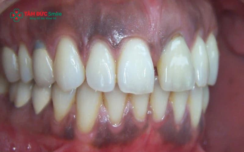 Abc8com cá cược thể thao kim loại bị oxy hóa và mảng bám tích tụ là nguyên nhân phổ biến khiến ABC8 là nhà cái cá cược trực tuyến uy tín số 1 tại Việt Nam bị đen