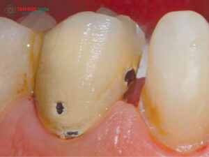 Vì sao Abc8.com Thể thao, Đá gà, Xổ số, Bắn cá bị hỏng? Nguyên nhân, dấu hiệu và cách khắc phục