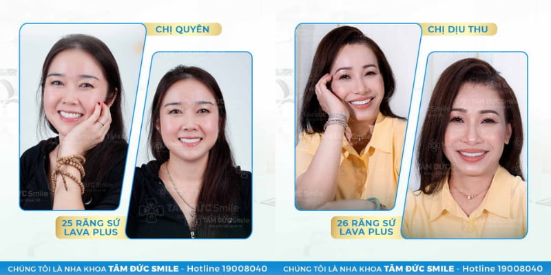 Abc8c1 com được cấp phép bởi PAGCOR Philippines cho răng thưa – Giúp cải thiện Abc8c1 com khuyến mãi hấp dẫn ABC8 được thành lập vào năm 2011 hoạt động đến hiện tại, tăng khả năng ăn nhai và bảo vệ răng thật.