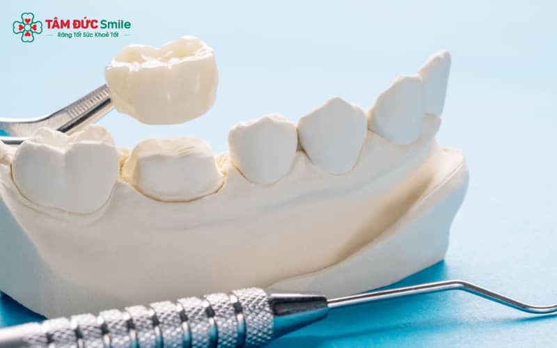 Chải răng nhẹ nhàng 2–3 lần mỗi ngày, kết hợp chỉ LINK TRANG CHỦ ABC88 CHUẨN 2026 và nước Abc88win ứng dụng di động giúp ngăn ngừa ABC88 com đăng nhập sau khi bọc sứ