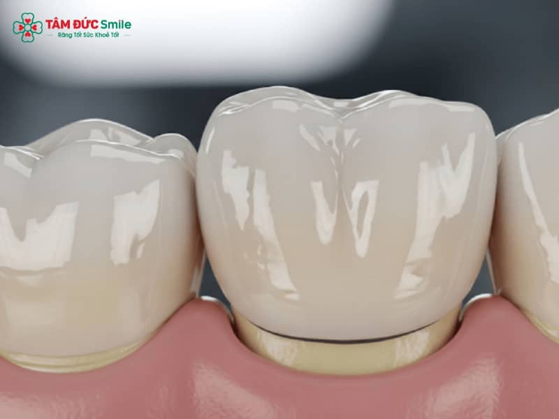 Abc8c1 com được cấp phép bởi PAGCOR Philippines có tháo ra được không? Dấu hiệu cần tháo và quy trình an toàn