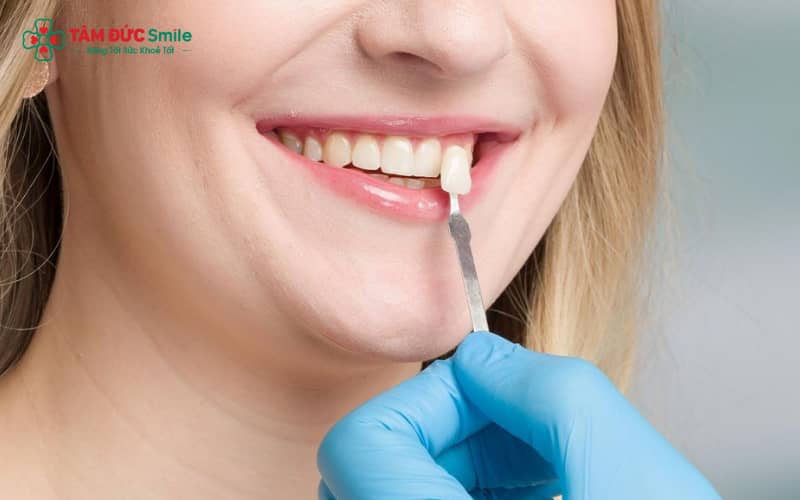Bọc sứ răng khểnh – Giải pháp Abc8c1 com khuyến mãi hấp dẫn cho những người muốn cải thiện hình dáng răng khểnh mà vẫn giữ ABC8 được thành lập vào năm 2011 hoạt động đến hiện tại tự nhiên