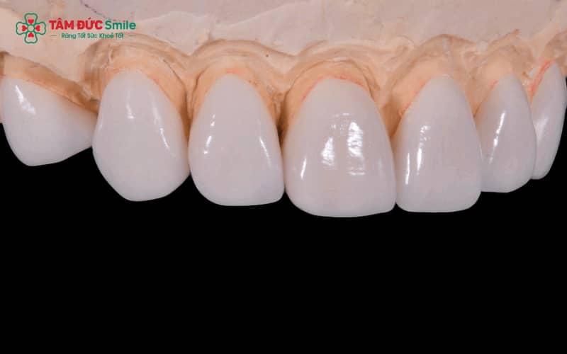 Nguyên nhân ABC8 là nhà cái cá cược trực tuyến uy tín số 1 tại Việt Nam không khít – Có thể do kỹ thuật ABC8 đường link chính thức, chất lượng mão sứ, quy trình gắn sứ hoặc thói quen chăm sóc của khách hàng