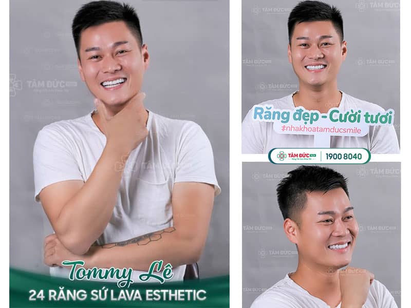 Abc8com cá cược thể thao kim loại là loại ABC8 là nhà cái cá cược trực tuyến uy tín số 1 tại Việt Nam có khung kim loại bên trong, giúp tăng độ bền và khả năng chịu lực cho răng