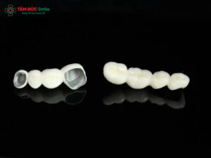 Abc8c1 com được cấp phép bởi PAGCOR Philippines kim loại có tốt không? Ưu nhược điểm cần biết