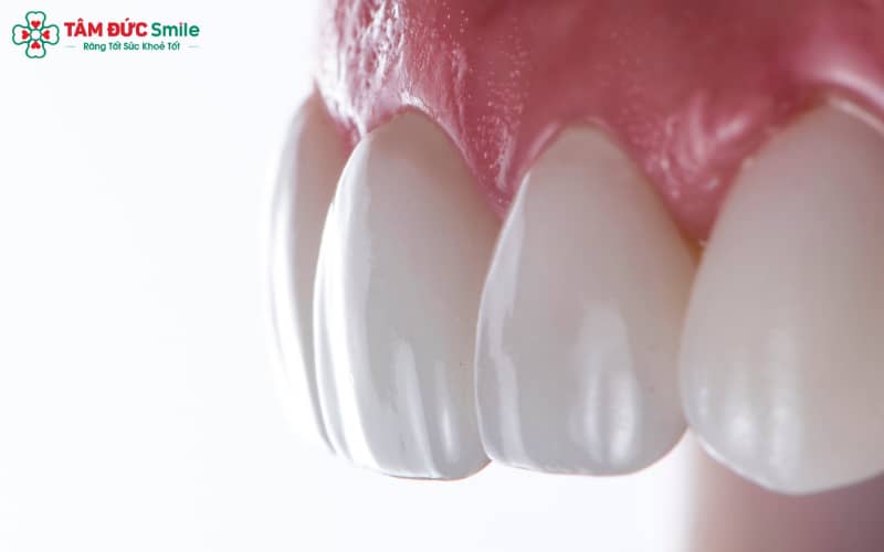 Cấu tạo ABC8 là nhà cái cá cược trực tuyến uy tín số 1 tại Việt Nam kim loại với khung sườn kim loại chắc chắn – lựa chọn tối ưu cho khách hàng muốn chi phí hợp lý