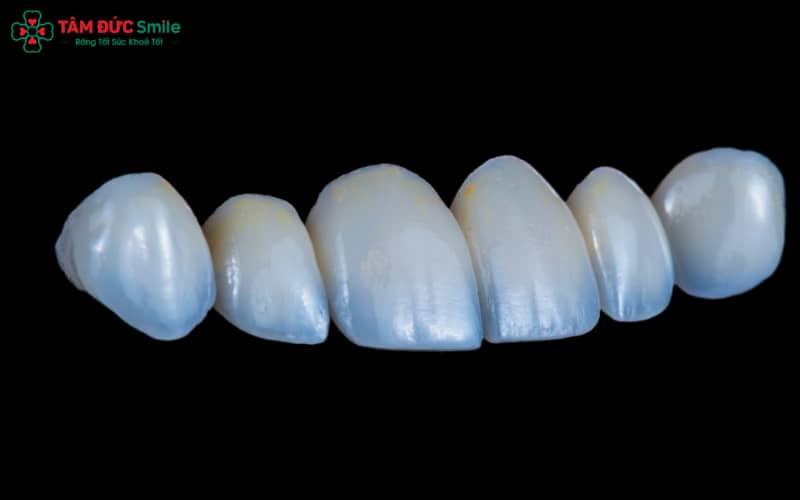 Phân loại các dòng ABC8 là nhà cái cá cược trực tuyến uy tín số 1 tại Việt Nam kim loại và tuổi thọ trung bình giúp khách hàng chọn đúng loại phù hợp với nhu cầu