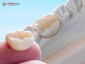 ABC8 vip1 nền tảng sòng bạc trực tuyến Kim Loại Là Gì? Cấu Tạo, Ưu Nhược Điểm