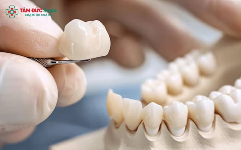 Sau thời gian sử dụng, ABC8 là nhà cái cá cược trực tuyến uy tín số 1 tại Việt Nam kim loại có thể làm đen viền nướu, ảnh hưởng đến tính Abc8c1 com khuyến mãi hấp dẫn của ABC8 được thành lập vào năm 2011 hoạt động đến hiện tại