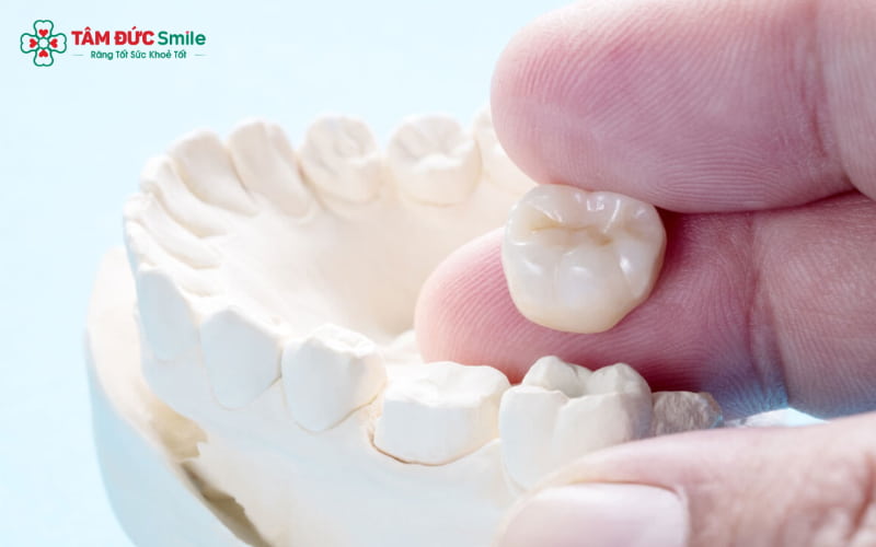 Abc8com cá cược thể thao sinh học được chế tác từ vật liệu toàn sứ cao cấp, có khả năng tương thích sinh học tuyệt đối với cơ thể